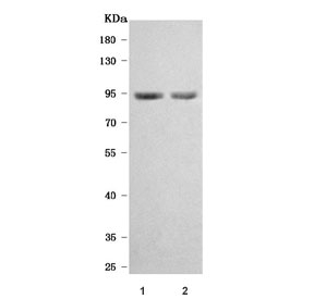 Western blot testing of 1) rat brain and 2) mouse brain tissue lysate with TMEM132B antibody. Predicted molecular weight ~95 kDa.
