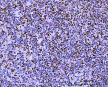 IHC staining of FFPE mouse spleen tissue with PAX5 antibody. HIER: boil tissue sections in pH8 EDTA for 20 min and allow to cool before testing.
