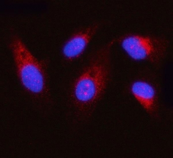 Immunofluorescent staining of FFPE human PC-3 cells with OXSM antibody (red) and DAPI nuclear stain (blue). HIER: steam section in pH6 citrate buffer for 20 min.