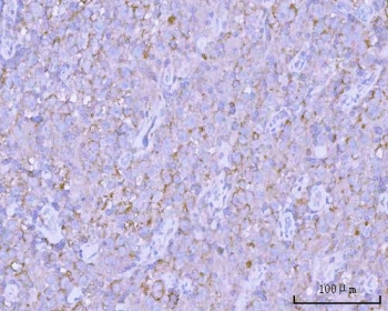 IHC staining of FFPE human testicular seminoma tissue with PITPNB antibody. HIER: boil tissue sections in pH8 EDTA for 20 min and allow to cool before testing.