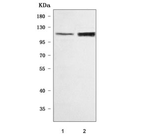 Western blot testing of human 1) 293T and 2) HEL cell lysate with ORP8 antibody. Predicted molecular weight ~101 kDa.