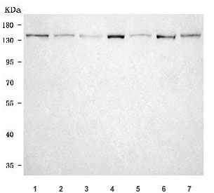 Western blot testing of 1) human HepG2, 2) human T-47D, 3) monkey COS-7, 4) rat liver, 5) rat brain, 6) mouse liver and 7) mouse brain tissue lysate with OPLAH antibody. Predicted molecular weight ~137 kDa.