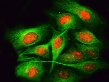 Immunofluorescent staining of FFPE human U-2 OS cells with RPRD1B antibody (red) and Beta Tubulin mAb (green). HIER: steam section in pH6 citrate buffer for 20 min.