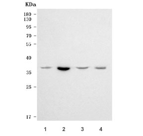 Western blot testing of 1) human HeLa, 2) human Jurkat, 3) human Caco-2 and 4) monkey COS-7 cell lysate with RPRD1B antibody. Predicted molecular weight ~37 kDa.
