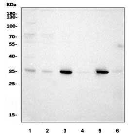 Western blot testing of 1) human Jurkat, 2) human HeLa, 3) rat brain, 4) rat kidney, 5) mouse brain and 6) mouse kidney tissue lysate with GNB1 antibody. Predicted molecular weight ~37 kDa.
