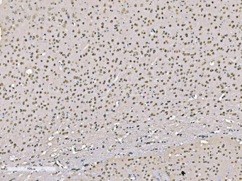 IHC staining of FFPE human mouse brain tissue with FUBP2 antibody. HIER: boil tissue sections in pH8 EDTA for 20 min and allow to cool before testing.