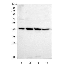 Western blot testing of human 1) Caco-2, 2) MCF7, 3) RT4 and 4) HaCaT cell lysate with PRSS22 antibody. Predicted molecular weight ~33 kDa but may be observed at higher molecular weights due to glycosylation.
