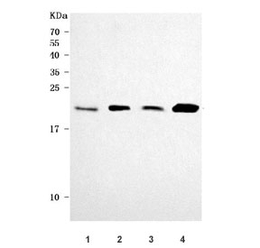 Western blot testing of human 1) HepG2, 2) HeLa, 3) 293T and 4) MCF7 cell lysate with PRDX2 antibody. Predicted molecular weight ~22 kDa.