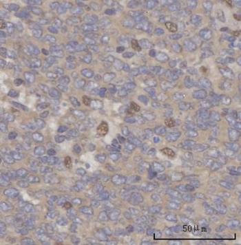IHC staining of FFPE human tonsil tissue with Selenocysteine lyase antibody. HIER: boil tissue sections in pH8 EDTA for 20 min and allow to cool before testing.