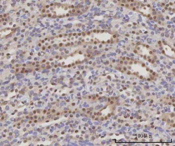 IHC staining of FFPE rat kidney tissue with Selenocysteine lyase antibody. HIER: boil tissue sections in pH8 EDTA for 20 min and allow to cool before testing.