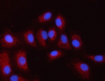 Immunofluorescent staining of FFPE human A549 cells with PXK antibody (red) and DAPI nuclear stain (blue). HIER: steam section in pH6 citrate buffer for 20 min.