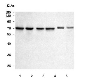 Western blot testing of 1) human 293T, 2) human A431, 3) human Jurkat, 4) human ThP-1, 5) rat liver and 6) mouse liver tissue lysate with NEIL3 antibody. Predicted molecular weight ~68 kDa.
