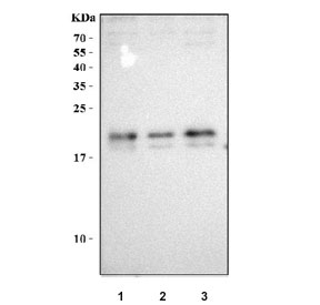 Western blot testing of human 1) SH-SY5Y, 2) Caco-2 and 3) HeLa cell lysate with NHP2 antibody. Predicted molecular weight ~17 kDa, commonly observed at 17-20 kDa.