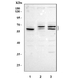 Western blot testing of human 1) A549, 2) HepG2 and 3) HeLa cell lysate with SEPN1 antibody. Predicted molecular weight ~62 kDa and ~69 kDa (two isoforms).