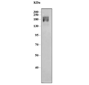 Western blot testing of human MCF7 cell lysate with PREX1 antibody. Predicted molecular weight: ~186 kDa, ~176 kDa and ~106 kDa (multiple isoforms).