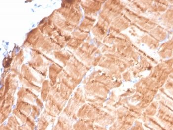 IHC staining of FFPE human skeletal muscle tissue with Tropomyosin antibody (clone TPM1/4510). HIER: boil tissue sections in pH 9 10mM Tris with 1mM EDTA for 20 min and allow to cool before testing.~
