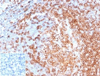 IHC staining of FFPE human tonsil tissue with recombinant CD22 antibody (clone rBLCAM/6749) at 2ug/ml. Negative control inset: PBS instead of primary antibody to control for secondary binding. HIER: boil tissue sections in pH 9 10mM Tris with 1mM EDTA for 20 min and allow to cool before testing.