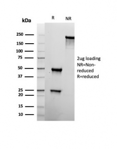 SDS-PAGE analysis of purified, BSA-free recombinant CD22 antibody (clone rBLCAM/6749) as confirmation of integrity and purity.