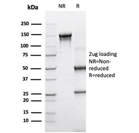 SDS-PAGE analysis of purified, BSA-free SERPINA3 antibody (clone SERPINA3/4190) as confirmation of integrity and purity.