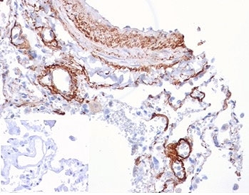 IHC staining of FFPE human lung tissue with Fibroblast Growth Factor 21 antibody (clone FGF21/4343). Negative control inset: PBS instead of primary antibody to control for secondary binding. HIER: boil tissue sections in pH 9 10mM Tris with 1mM EDTA for 20 min and allow to cool before testing.