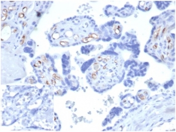 IHC staining of FFPE human placental tissue with FABP4 antibody (clone FABP4/4426) at 2ug/ml. Negative control inset: PBS instead of primary antibody to control for secondary binding. HIER: boil tissue sections in pH 9 10mM Tris with 1mM EDTA for 20 min and allow to cool before testing.