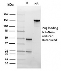 SDS-PAGE analysis of purified, BSA-free FABP4 antibody (clone FABP4/4426) as confirmation of integrity and purity.