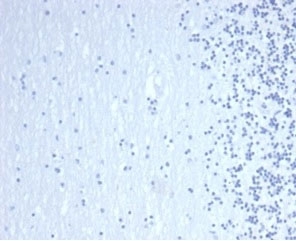 Negative control: IHC staining of FFPE human brain tissue with GATA Binding Protein 3 antibody (clone GATA3/6664) at 2ug/ml in PBS for 30min RT. HIER: boil tissue sections in pH 9 10mM Tris with 1mM EDTA for 20 min and allow to cool before testing.