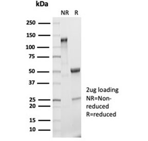 SDS-PAGE analysis of purified, BSA-free recombinant IL-2 antibody (clone IL2/7050R) as confirmation of integrity and purity.