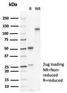 SDS-PAGE analysis of purified, BSA-free recombinant Surfactant protein D antibody (clone SFTPD/7084R) as confirmation of integrity and purity.