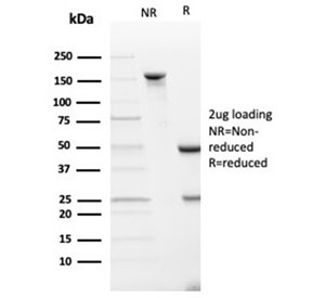 SDS-PAGE analysis of purified, BSA-free SPARC antibody (clone OSTN/3933) as confirmation of integrity and purity.