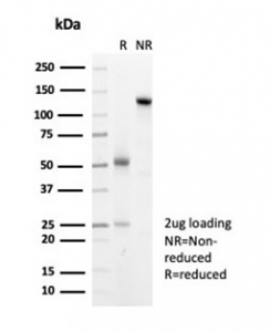 SDS-PAGE analysis of purified, BSA-free recombinant HSP27 antibody (clone HSPB1/7038R) as confirmation of integrity and purity.