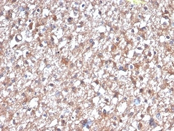 IHC staining of FFPE human brain tissue with PKC iota antibody (clone PRKCI/4912). HIER: boil tissue sections in pH 9 10mM Tris with 1mM EDTA for 20 min and allow to cool before testing.
