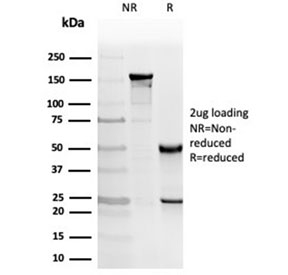 SDS-PAGE analysis of purified, BSA-free PKC iota antibody (clone PRKCI/4912) as confirmation of integrity and purity.