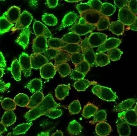 Immunofluorescent staining of PFA-fixed human HeLa cells using MED22 antibody (green, clone PCRP-MED22-1E4) and phalloidin (red).