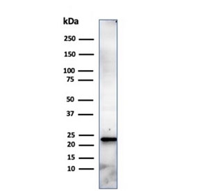 Western blot testing of human HeLa cell lysate using CBF beta antibody (clone PCRP-CBFB-1E6). Predicted molecular weight ~22 kDa.