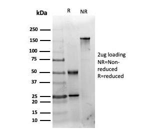 SDS-PAGE analysis of purified, BSA-free HDAC3 antibody (clone PCRP-HDAC3-2D4) as confirmation of integrity and purity.