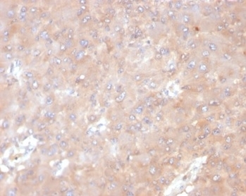 IHC staining of FFPE human tonsil tissue with IL-6 antibody (clone IL6/4641) at 2ug/ml. HIER: boil tissue sections in pH 9 10mM Tris with 1mM EDTA for 20 min and allow to cool before testing.