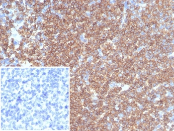 IHC staining of FFPE human tonsil tissue with recombinant CD45RA antibody (clone rPTPRC/7284). Negative control inset: PBS instead of primary antibody to control for secondary binding. HIER: boil tissue sections in pH 9 10mM Tris with 1mM EDTA for 20 min and allow to cool before testing.