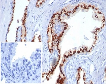 IHC staining of FFPE human prostate tissue with recombinant Prostein antibody (clone SLC45A3/7176R). Negative control inset: PBS instead of primary antibody to control for secondary binding. HIER: boil tissue sections in pH 9 10mM Tris with 1mM EDTA for 20 min and allow to cool before testing.