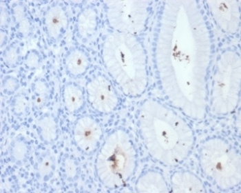 IHC staining of FFPE Helicobacter pylori-infected human stomach tissue with H pylori antibody (clone HPYL/7228). HIER: boil tissue sections in pH 9 10mM Tris with 1mM EDTA for 20 min and allow to cool before testing.