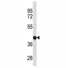 HLA-B antibody western blot analysis in Ramos lysate.