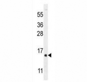 hCG1995004 antibody western blot analysis in Y79 lysate.