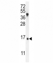 IGKV antibody western blot analysis in MDA-MB435 lysate.