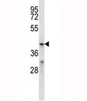 MFSD2B antibody western blot analysis in ZR-75-1 lysate.