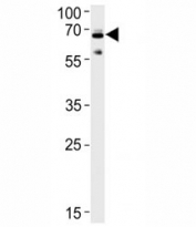 Ubiquilin1 antibody western blot analysis in SH-SY5Y lysate