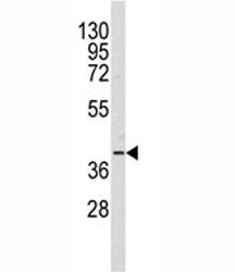 Western blot analysis of AKR1A1 antibody and Y79 lysate