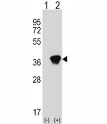 Western blot analysis of AKR1A1 antibody and 293 cell lysate (2 ug/lane) either nontransfected (Lane 1) or transiently transfected (2) with the AKR1A1 gene.