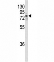 Western blot analysis of TNK1 antibody and T47D lysate.