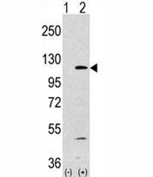 Western blot analysis of PI3KCA antibody and 293 lysate transiently transfected with the PIK3CA gene (1ug/lane).