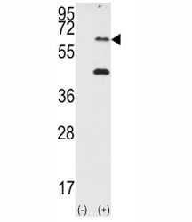 Western blot analysis of PKR antibody and 293 cell lysate (2 ug/lane) either nontransfected (Lane 1) or transiently transfected with the EIF2AK2/PKR gene (2).